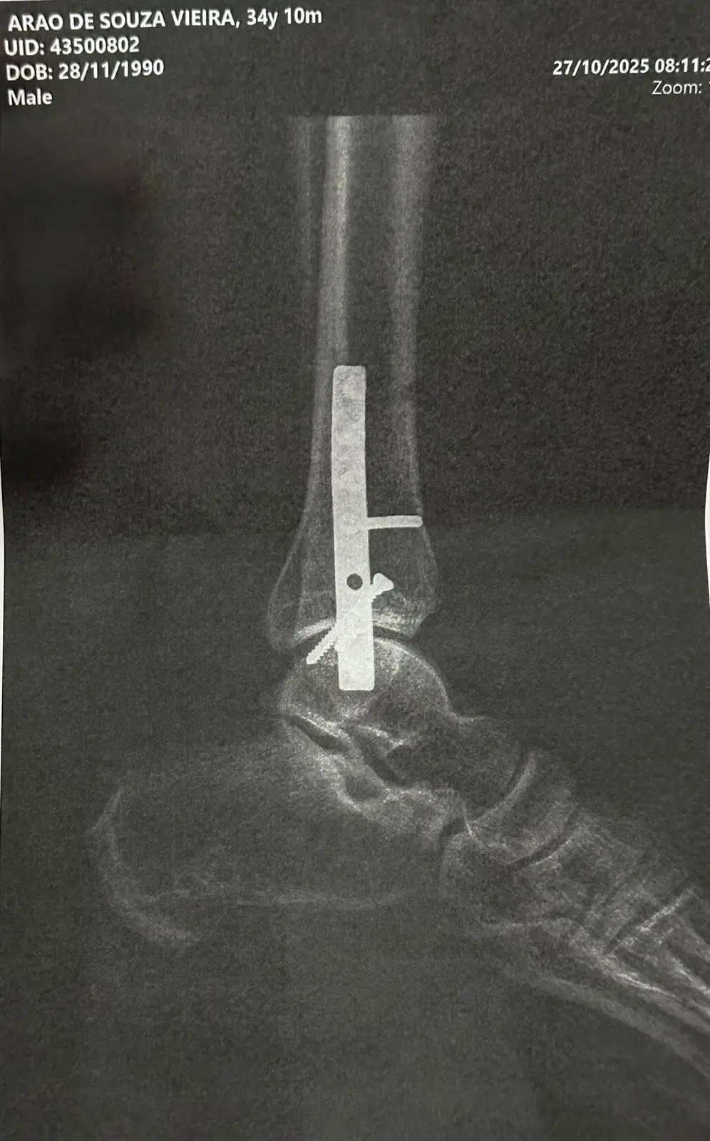 12ª imagem da campanha