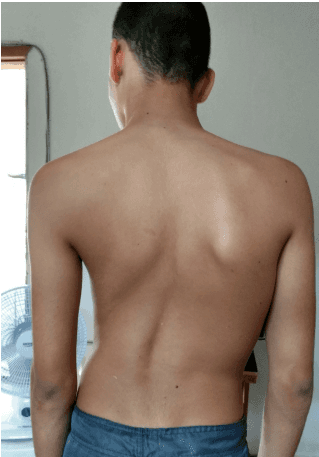 3ª imagem da campanha