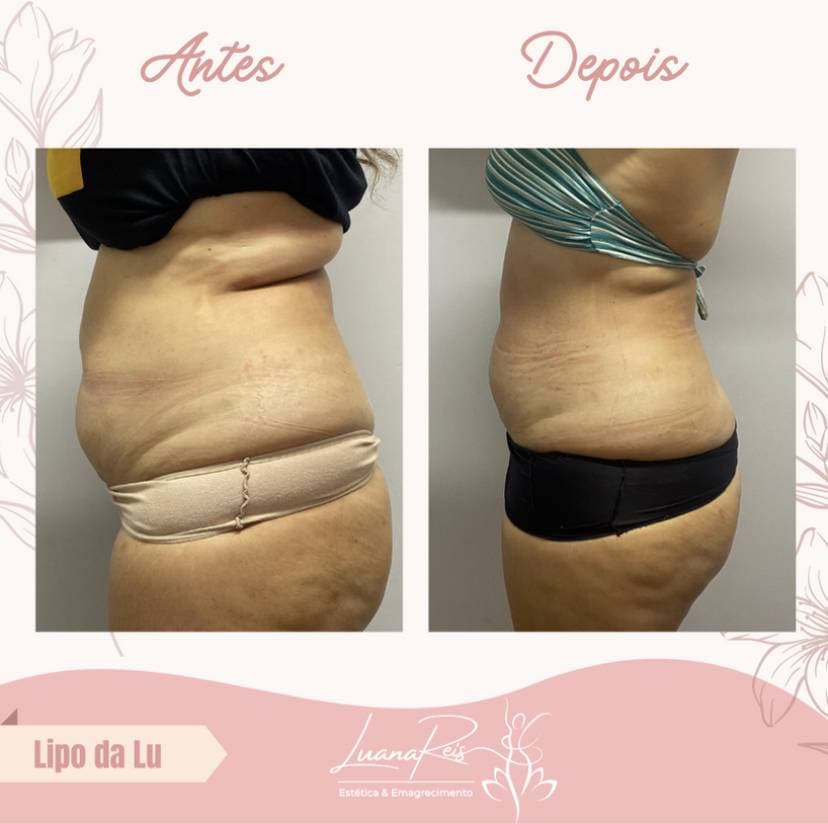 2ª imagem da campanha