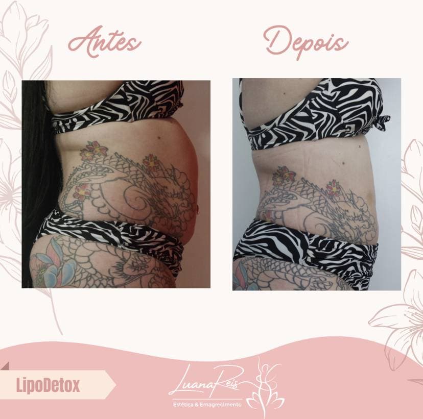 7ª imagem da campanha