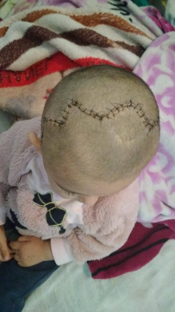 2ª imagem da campanha