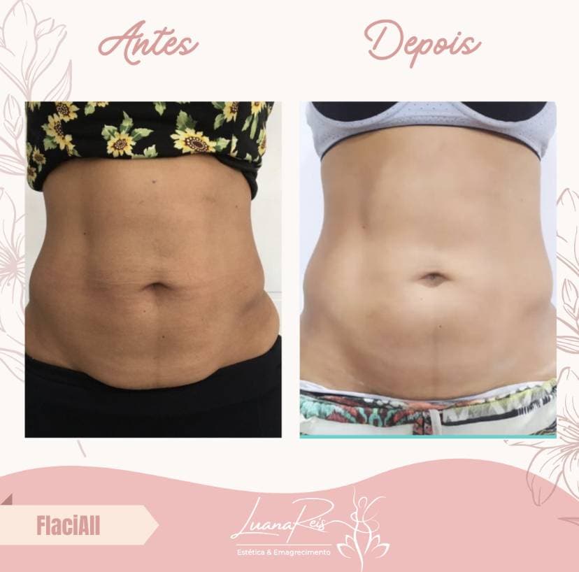 4ª imagem da campanha