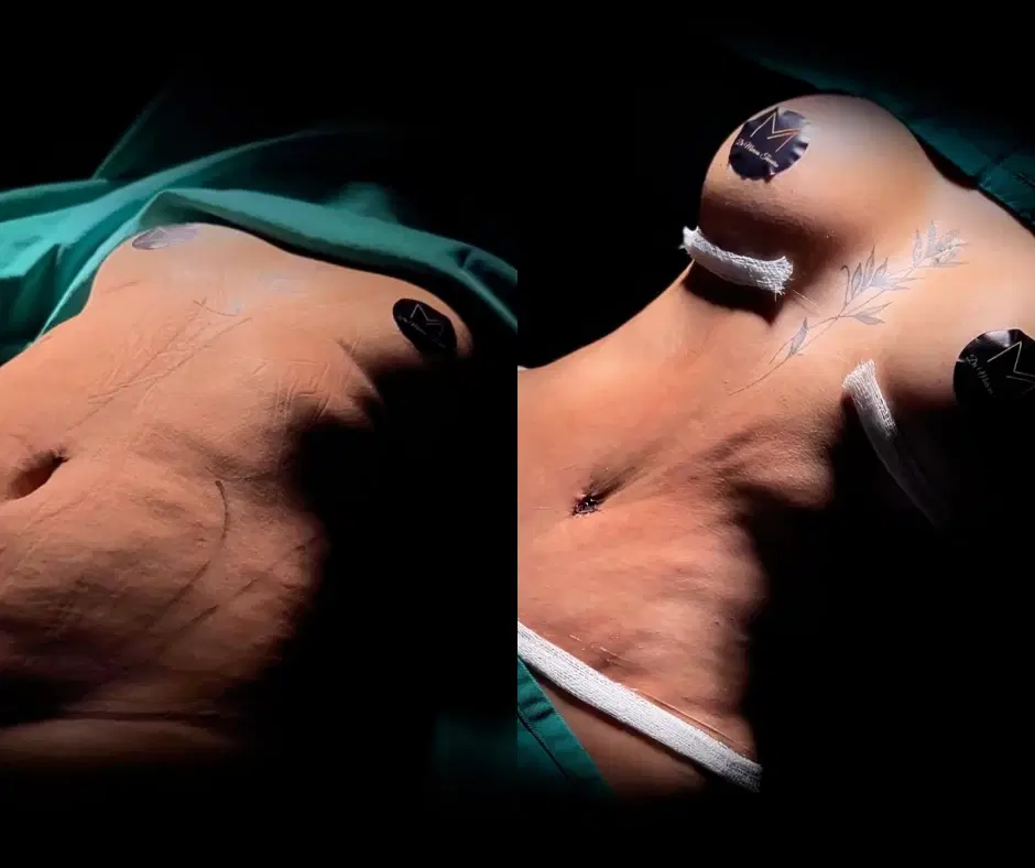 2ª imagem da campanha