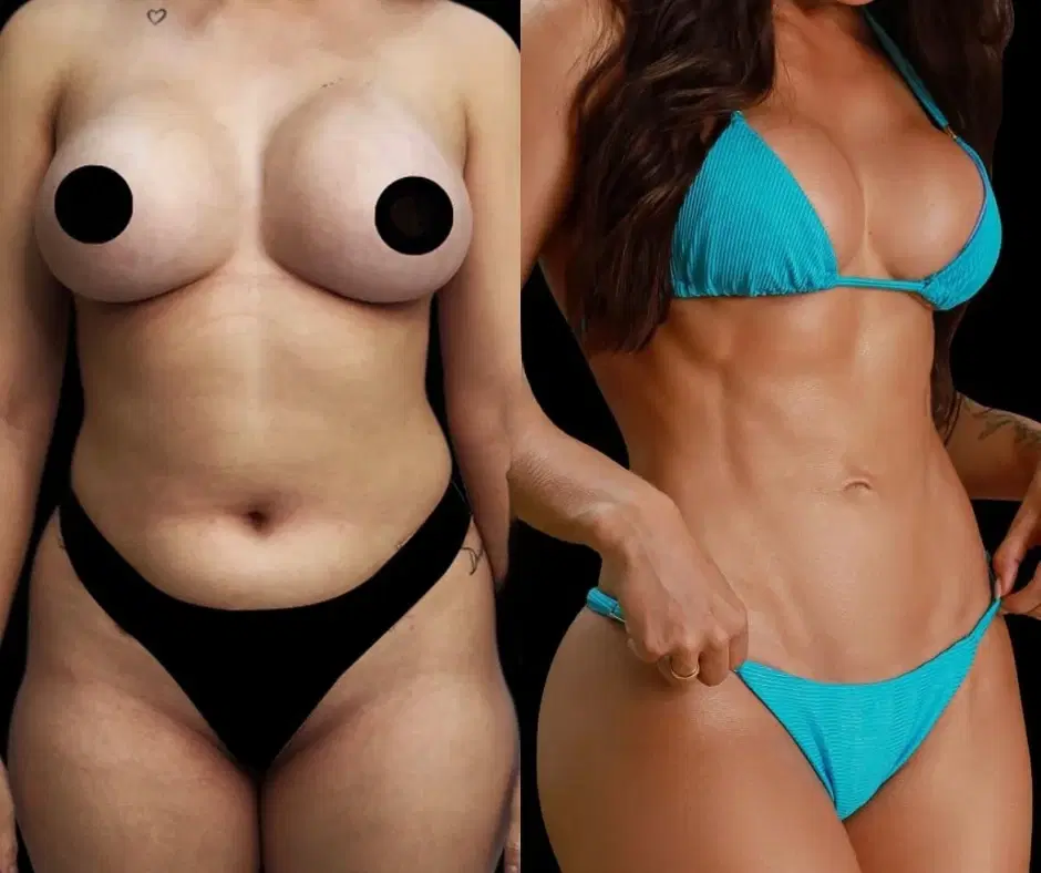 6ª imagem da campanha