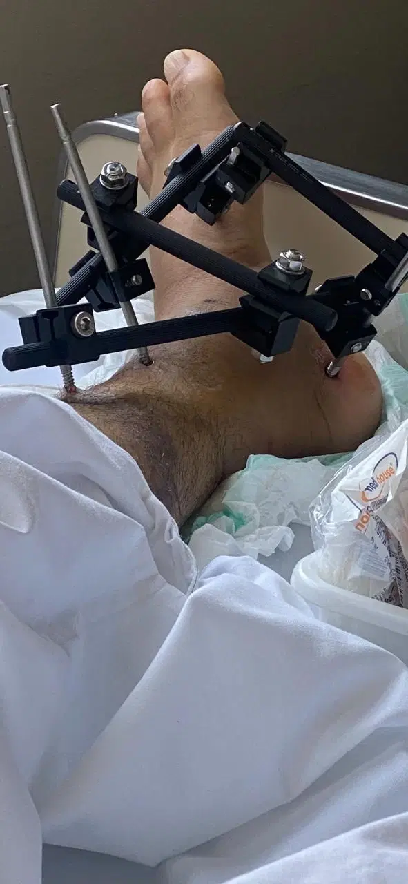 4ª imagem da campanha