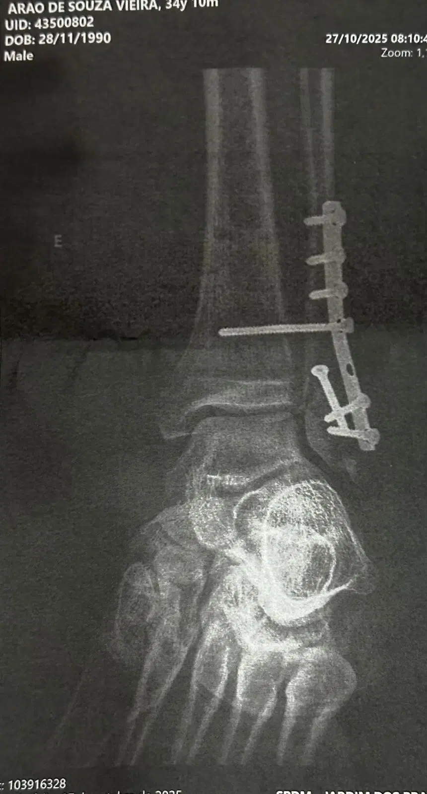 11ª imagem da campanha